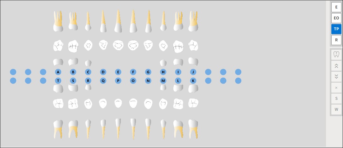 Odontogram showing primary teeth 